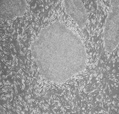 凍結解凍後のヒトiPS細胞（京大株）の画像