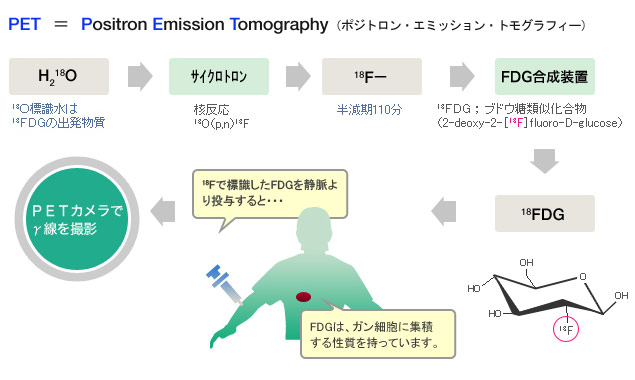 図1：Water-18Oを用いた18FDG-PET診断の画像